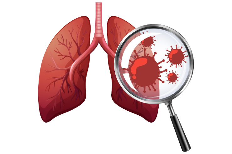 Bronchoscopy & Diagnostic Procedures​